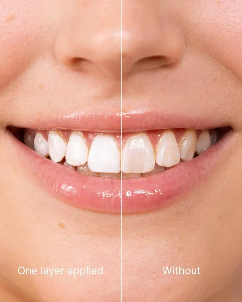 🆙🦷Instant Teeth Whitening Polish - Enamel Safe Tooth Gloss for Yellow Teeth Stain Removal - Fluoride-Free & Sensitivity Free