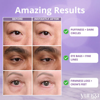 ✨GLANARIVA® Instant Eye Tightener | No White Residue & Makeup Safe