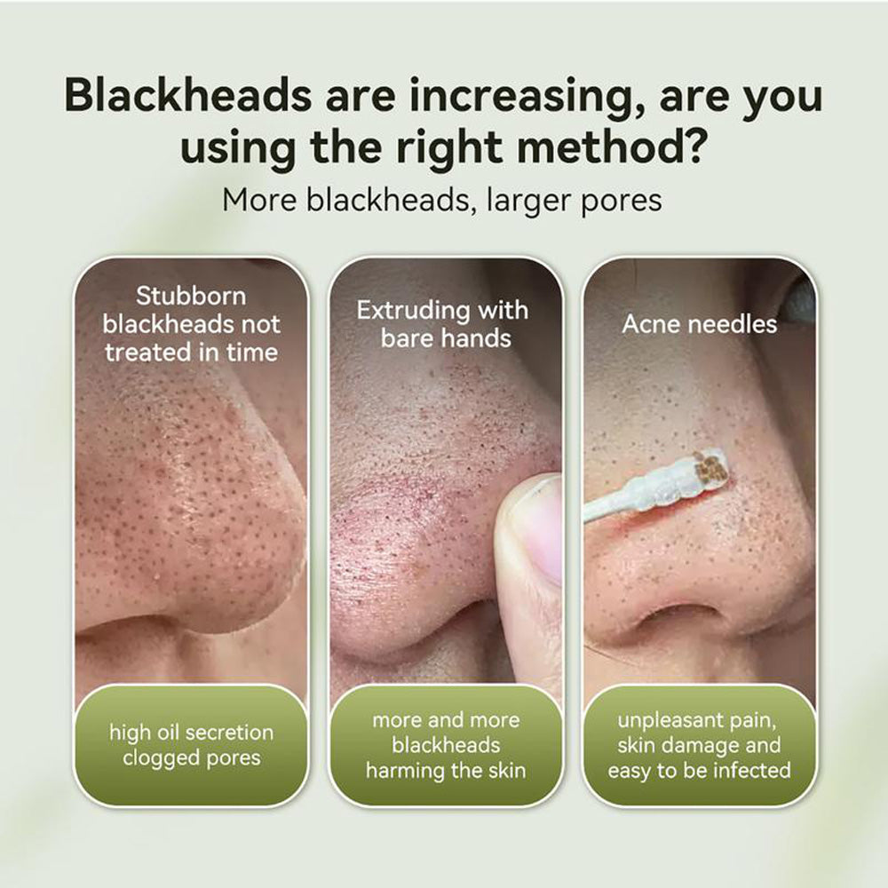🌿GLANARIVA® Blackhead Remover Peel-Off Mask | Deep Pore Cleansing