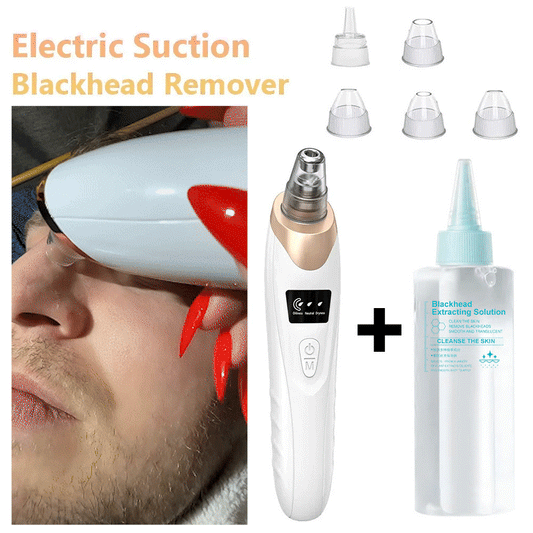 🆙Electric Pore Vacuum & Blackhead Remover – Rechargeable Spot Extractor Tool Setf