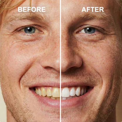 ✨🦷Instant Teeth Whitening Polish  - Enamel Safe Tooth Gloss for Yellow Teeth Stain Removal - Fluoride-Free & Sensitivity Free