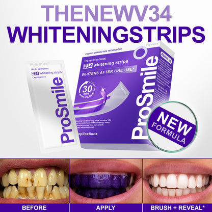 🦷𝐅𝐥𝐲𝐬𝐦𝐮𝐬® 𝐕𝟑𝟒 𝐖𝐇𝐈𝐓𝐄𝐍𝐈𝐍𝐆 𝐒𝐓𝐑𝐈𝐏𝐒 — Clinically proven to gently remove stains, whiten teeth, and restore natural brightness in just 30 minutes — safe for sensitive teeth and gums.