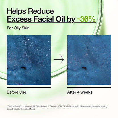 🔬GLANARIVA® 10% Azelaic Acid Redness Soothing Serum
