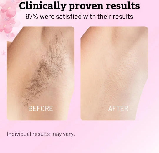🌿GLANARIVA® Cyperus Rotundus Hair Inhibitor Oil