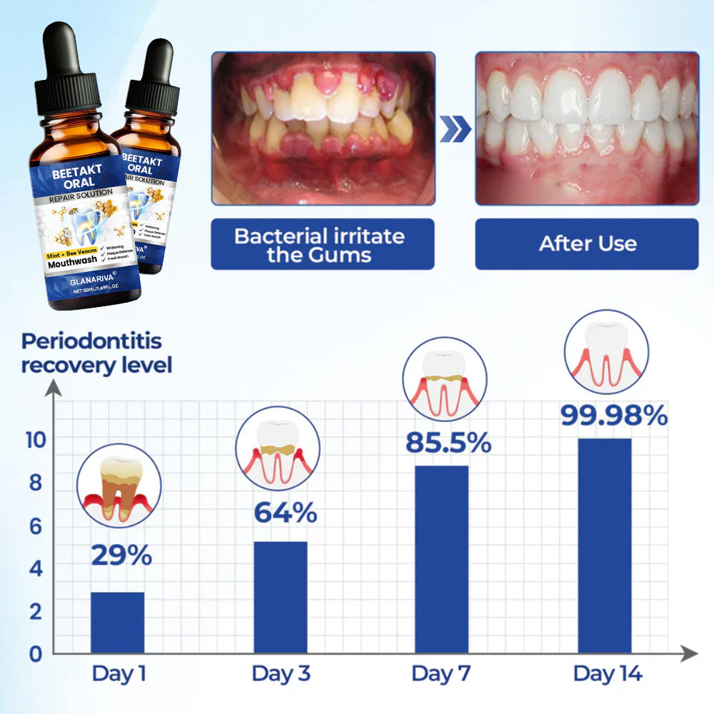 🌿GLANARIVA® Oral Repair Solution, Bee Venom Concentrated Drops for Receding Gums, Bleeding & Plaque, Advanced Mouthwash Alternative