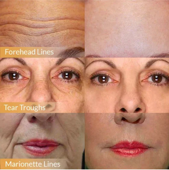 🌿Glanariva® Advanced Polypeptide Firming Cream: Transform Your Skin in 14 Days