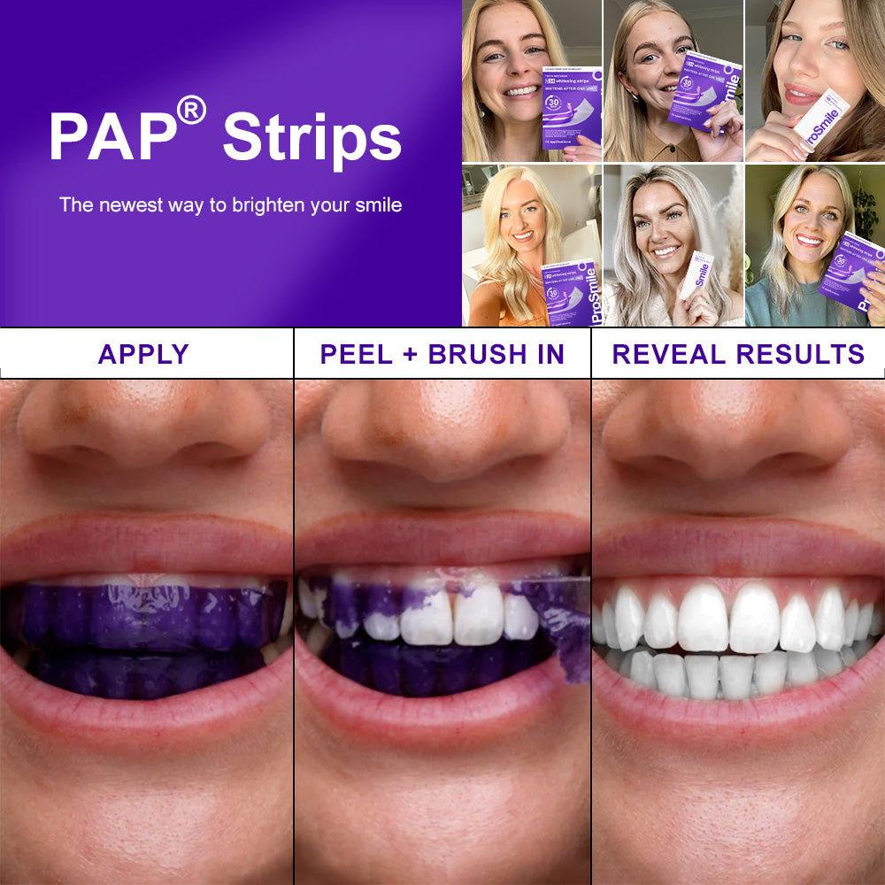 🦷𝐅𝐥𝐲𝐬𝐦𝐮𝐬® 𝐕𝟑𝟒 𝐖𝐇𝐈𝐓𝐄𝐍𝐈𝐍𝐆 𝐒𝐓𝐑𝐈𝐏𝐒 — Clinically proven to gently remove stains, whiten teeth, and restore natural brightness in just 30 minutes — safe for sensitive teeth and gums.