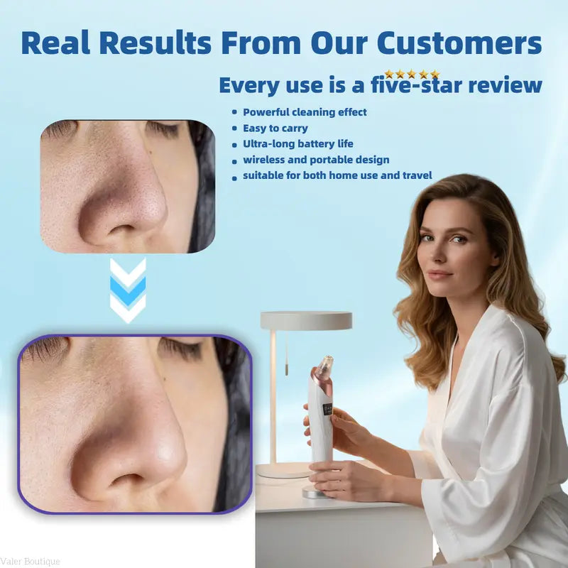 🫧Electric Pore Vacuum & Blackhead Remover – Rechargeable Spot Extractor Tool Set