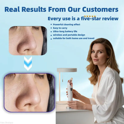 🫧Electric Pore Vacuum & Blackhead Remover – Rechargeable Spot Extractor Tool Set