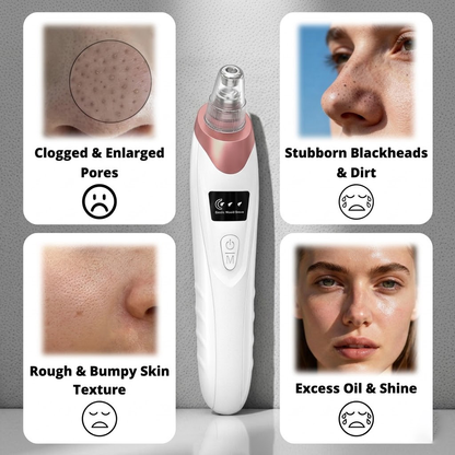 🫧Electric Pore Vacuum & Blackhead Remover – Rechargeable Spot Extractor Tool Set